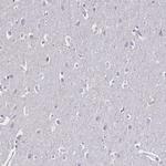 C20orf107 Antibody in Immunohistochemistry (Paraffin) (IHC (P))