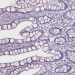 C20orf107 Polyclonal Antibody