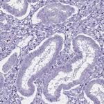 C20orf107 Antibody in Immunohistochemistry (IHC)
