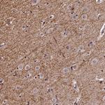 REXO1 Antibody in Immunohistochemistry (Paraffin) (IHC (P))