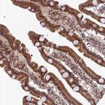 REXO1 Antibody in Immunohistochemistry (Paraffin) (IHC (P))