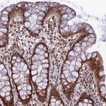 REXO1 Antibody in Immunohistochemistry (IHC)