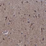 GTPBP3 Antibody in Immunohistochemistry (Paraffin) (IHC (P))