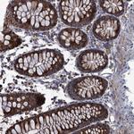 GTPBP3 Antibody in Immunohistochemistry (Paraffin) (IHC (P))