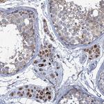 GTPBP3 Antibody in Immunohistochemistry (Paraffin) (IHC (P))