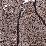 SNRK Antibody in Immunohistochemistry (Paraffin) (IHC (P))
