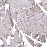 SNRK Antibody in Immunohistochemistry (Paraffin) (IHC (P))