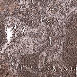 SNRK Antibody in Immunohistochemistry (Paraffin) (IHC (P))