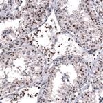 SNRK Antibody in Immunohistochemistry (Paraffin) (IHC (P))