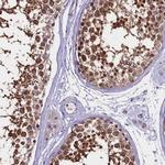 C9orf40 Antibody in Immunohistochemistry (IHC)