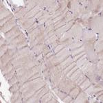 C9orf40 Antibody in Immunohistochemistry (IHC)