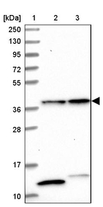 CIAPIN1 Antibody in Western Blot (WB)