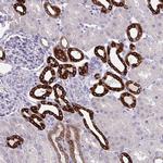 HSD11B2 Antibody in Immunohistochemistry (IHC)