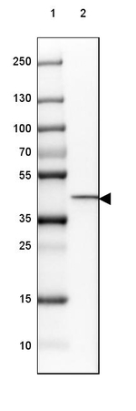 HSD11B2 Antibody in Western Blot (WB)