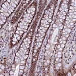 TCP11L2 Antibody in Immunohistochemistry (Paraffin) (IHC (P))