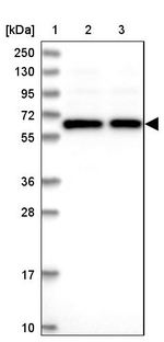 TCP11L2 Antibody in Western Blot (WB)