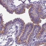 IFT140 Polyclonal Antibody