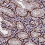 GPSM1 Antibody in Immunohistochemistry (Paraffin) (IHC (P))