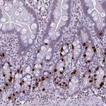 Histone H4 Antibody in Immunohistochemistry (IHC)