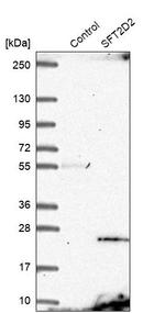 SFT2D2 Antibody in Western Blot (WB)