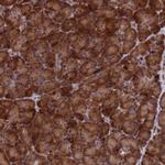 SH3D21 Polyclonal Antibody