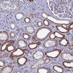 DTWD1 Antibody in Immunohistochemistry (Paraffin) (IHC (P))