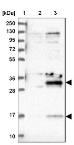 DTWD1 Antibody in Western Blot (WB)