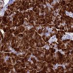 Aquaporin 12 Antibody in Immunohistochemistry (Paraffin) (IHC (P))