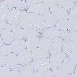 Aquaporin 12 Antibody in Immunohistochemistry (Paraffin) (IHC (P))