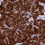 Aquaporin 12 Antibody in Immunohistochemistry (IHC)