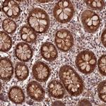 ZNF480 Antibody in Immunohistochemistry (Paraffin) (IHC (P))