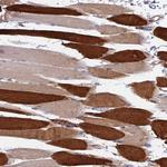 TRIM43 Polyclonal Antibody