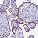 PSG11 Polyclonal Antibody