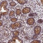 PYGO1 Antibody in Immunohistochemistry (Paraffin) (IHC (P))