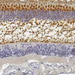RP1 Antibody in Immunohistochemistry (IHC)
