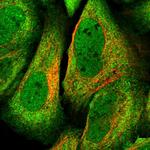 ADRM1 Polyclonal Antibody