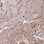 ADRM1 Antibody in Immunohistochemistry (Paraffin) (IHC (P))