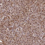 ADRM1 Antibody in Immunohistochemistry (Paraffin) (IHC (P))