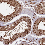 ADRM1 Antibody in Immunohistochemistry (Paraffin) (IHC (P))