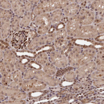 ADRM1 Antibody in Immunohistochemistry (Paraffin) (IHC (P))