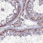 PSMD11 Polyclonal Antibody