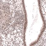 MGA Antibody in Immunohistochemistry (IHC)