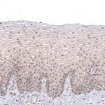 MGA Polyclonal Antibody