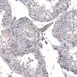 MGA Antibody in Immunohistochemistry (IHC)