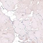 MGA Antibody in Immunohistochemistry (IHC)