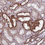 IL20RA Polyclonal Antibody