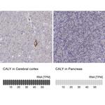 CALY Polyclonal Antibody