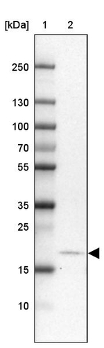 CALY Antibody in Western Blot (WB)