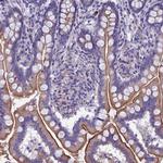 TMEM171 Antibody in Immunohistochemistry (Paraffin) (IHC (P))