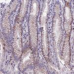 TMEM171 Antibody in Immunohistochemistry (Paraffin) (IHC (P))
